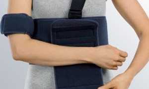 Бандажи и ортезы при травмах плеча и плечевого сустава: как выбирать и носить